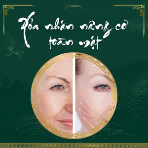 Xóa Nhăn Nâng Cơ Toàn Mặt