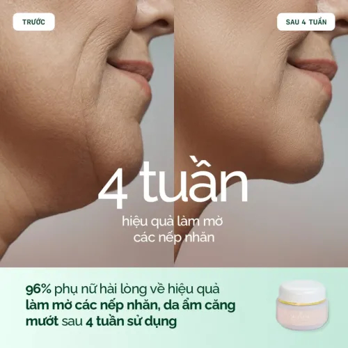 Kem Dưỡng Ẩm Hữu Cơ Chống Lão Hóa Dầu Argan My Body VIP. SX tại Pháp. Cấp Ẩm Sâu, Phục Hồi Da 50ml